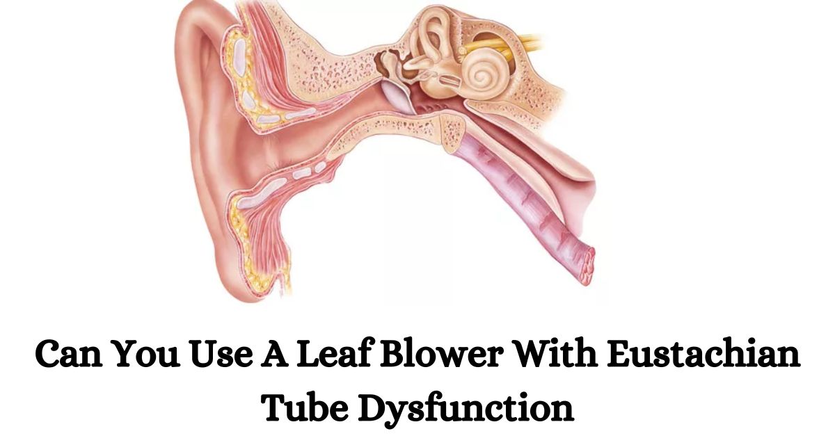 Eustachian Tube Dysfunction